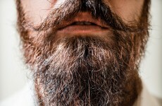 New York hipsters have created a beard transplant boom