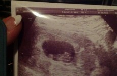 X Factor star discovers she's pregnant in supermarket toilet... It's The Dredge