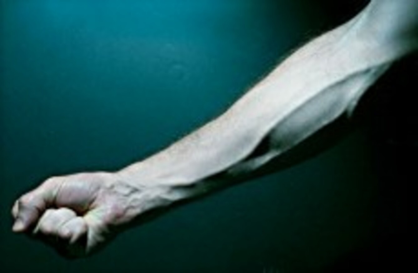 Here is why your veins look blue · TheJournal.ie