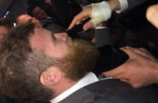 Sexton shaves D'Arcy's magnificent beard off after Six Nations win