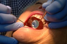 Two people in Ireland die every week from mouth cancers