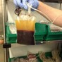 Stocks of Ireland's most common blood group are down