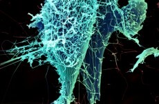 Aid agency worker dies as Ebola outbreak spreads