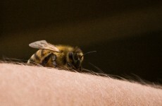 What's the worst place to be stung by a bee? This student has found out...