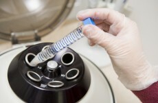 Poll: Should sperm, egg and embryo donors be paid expenses?