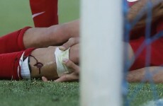 Diego Costa collides with the post while scoring and takes a chunk out of his shin