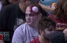 No doubt about it, this guy was the clear winner of Zombie Night