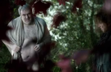 Irish actor hilariously describes wearing a fake willy on Game of Thrones (NSFW)