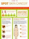 Infographic: Here's how you spot skin cancer