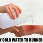 10 of the most epic burns the world has ever seen