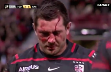 Florian Fritz sustains big knock to the head but returns to play after stitches