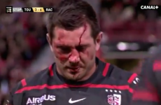 Fritz fiasco a stark reminder that rugby needs ongoing concern around head injuries