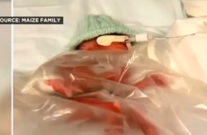 A tiny baby weighing less than a pound was born this week