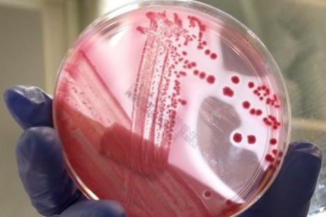 An employee of the laboratory at Hamburg Eppendorf hospital shows a bacterial culture of the EHEC bacterium. 