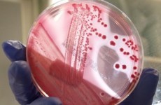 Deadly E.coli outbreak caused by new strain, says WHO