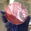 Deadly E.coli outbreak caused by new strain, says WHO