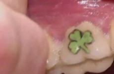 Teeth tattoos are a thing now, and they're awful