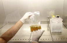 E.coli strain will "inevitably" spread to Ireland