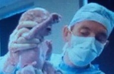 The Quadfather - Limerick couple welcome quadruplets after four years trying