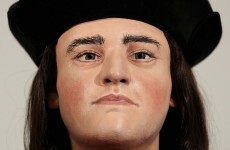 The "hunch-back'd" King Richard III did have a hunch, but a 'good tailor' would have hidden it