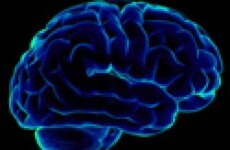 Irish research may lead to Alzheimer's breakthrough
