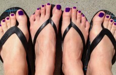 Man paints his toenails purple to support wife with cancer, internet joins in