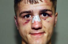 Marc McCullough was in the wars last night - and he has the bruises to prove it