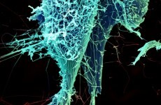 West Africa's Ebola virus outbreak is now "out of control"