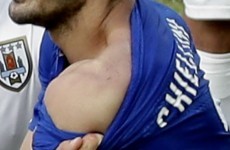 Snapshot: Here's Giorgio Chiellini's shoulder after his 'run-in' with Luis Suarez