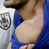 Snapshot: Here's Giorgio Chiellini's shoulder after his 'run-in' with Luis Suarez
