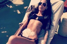 This powerful photo of a bikini wearer with a colostomy bag has gone ultra-viral