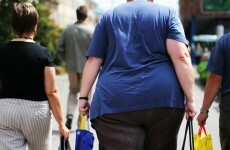 HIQA are looking for comments on referral thresholds for gastrointestinal procedures