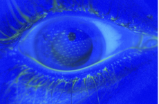 An airbag slammed into a 17-year-old's eye before she had time to blink