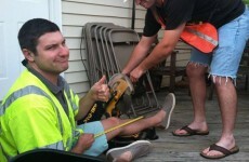 Amputee says goodbye to his foot in heartwarming photo diary