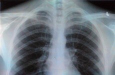 7 deeply unsettling facts about your body that you didn't know