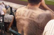 Baseball fan pays tribute to favourite player with 'back hair jersey'