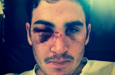 Craig Kieswetter nailed the 'Cricket is a Tough Game' Selfie