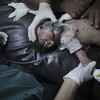 Gaza death toll passes 300 as UN chief heads to region