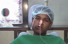 Think your dentist visit was bad? This Indian teen had 232 teeth 'chiselled out'