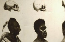 What can we learn from race science?