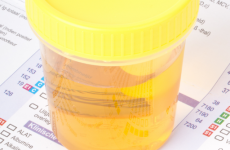 Irish startup to develop breakthrough biotechnology test for major US clinic