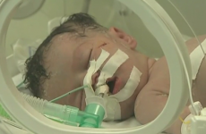 Baby delivered from dead mother in Gaza