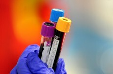 Thousands of Irish could have this 'hidden' disease and not know it