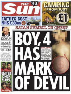 The Sun criticised for 'irresponsible' front page of boy with 'devil mark'