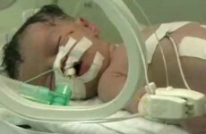 'Miracle' Gaza baby born to dead mother is said to have died