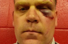 Referee takes spinning heel kick to the face, continues refereeing
