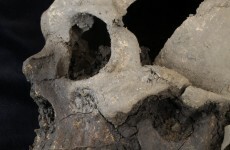 Multiple human remains found outside Trinity College