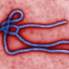 Ebola virus ruled out for patient in Dublin hospital