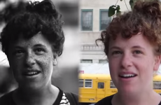Ultraviolet camera shows exactly how the sun's rays affect our skin