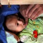 28 million people in the Middle East need humanitarian aid